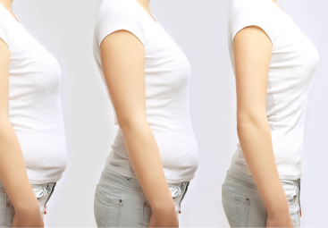 Plastic Surgery Trends for 2026: The Impact of Weight-Loss Drugs